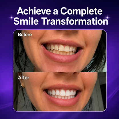 🔥HOT SALE🔥 Purple Teeth Whitening Strips